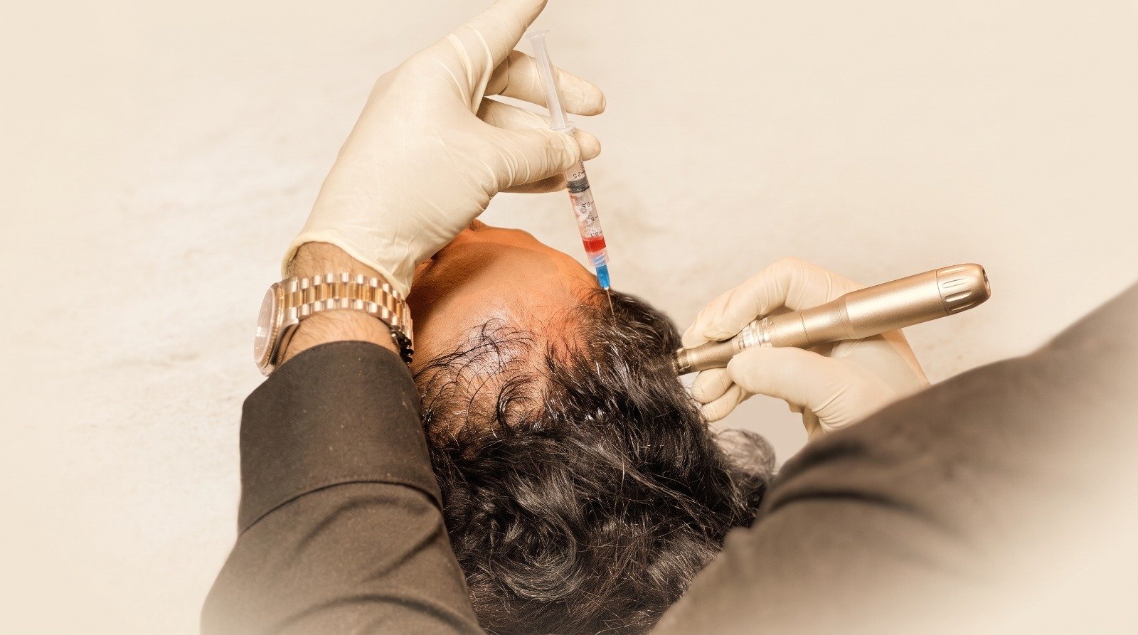 PRP for hair at CHANRI Clinic