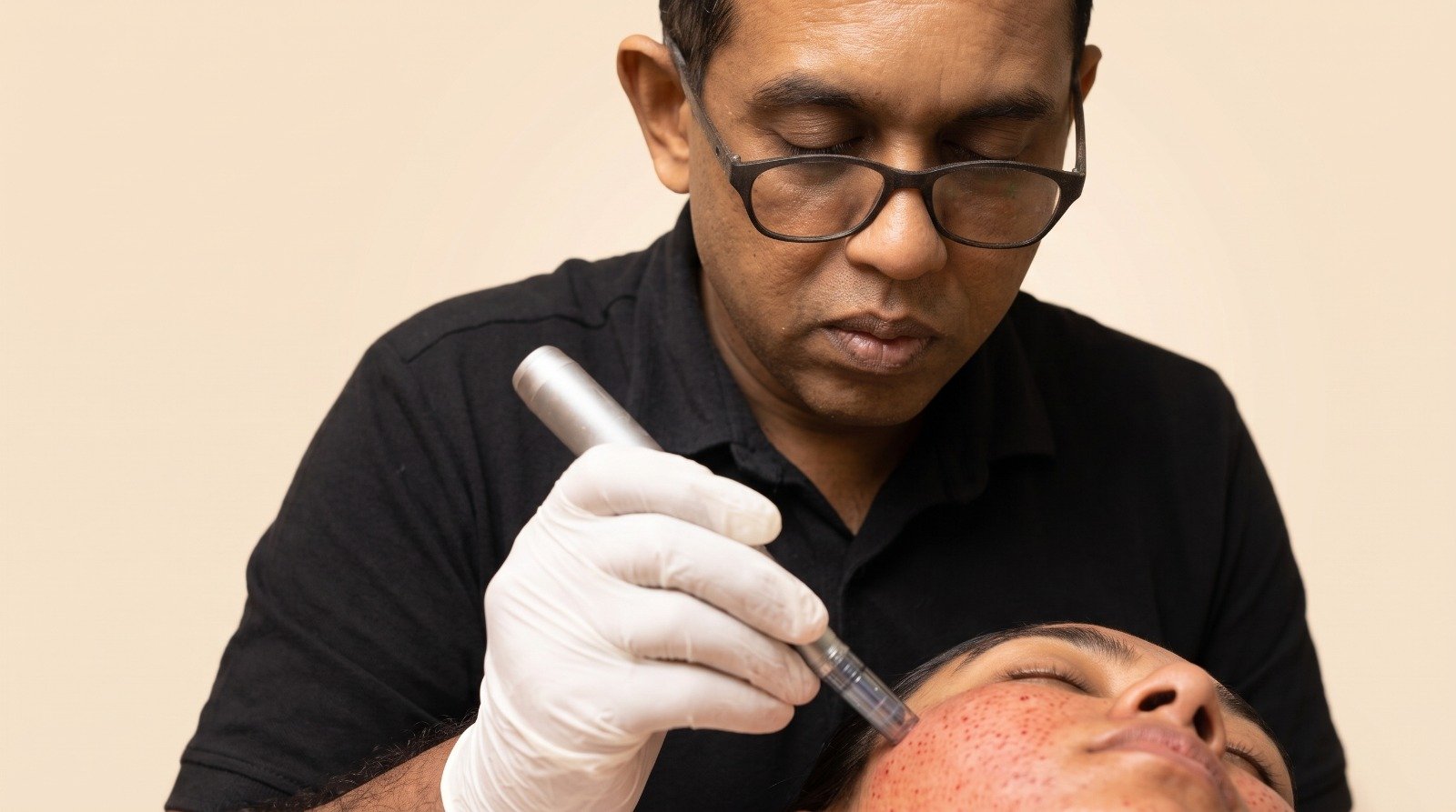 PRP for skin at CHANRI Clinic