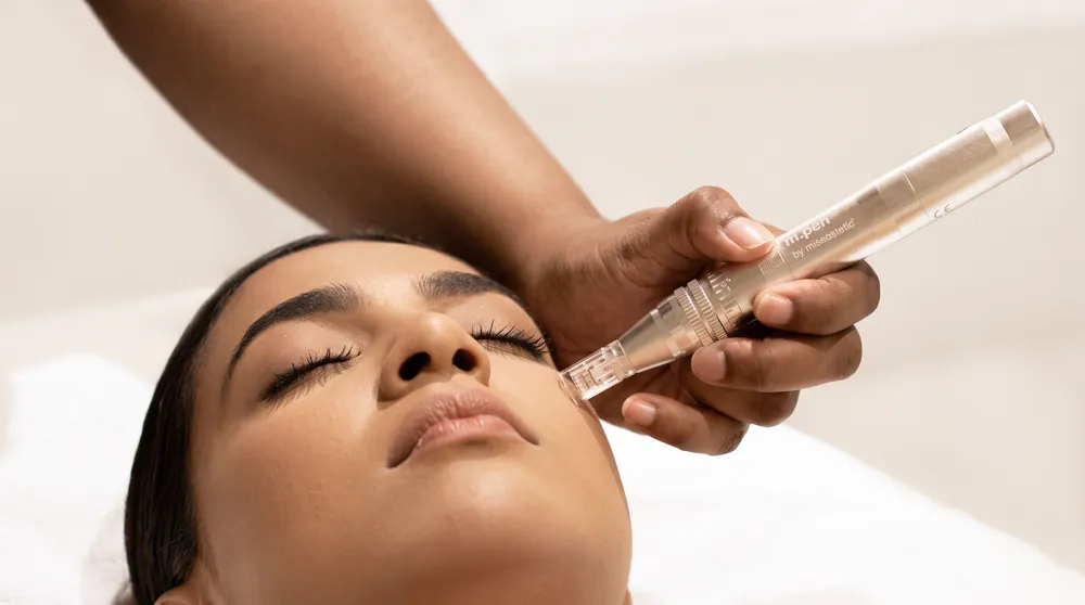 Micro-needling treatment at CHANRI Clinic